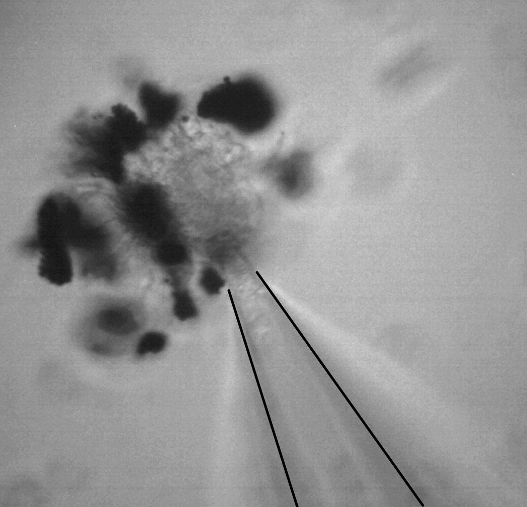 2022 11 03Eye E 40X. Edit